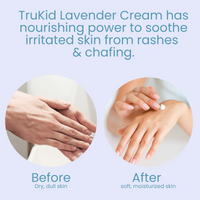 TruKid-Lavender-Cream can nourish and soothe itching skin